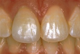 second image