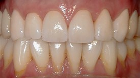 second image