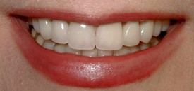 second image
