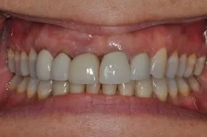 first image