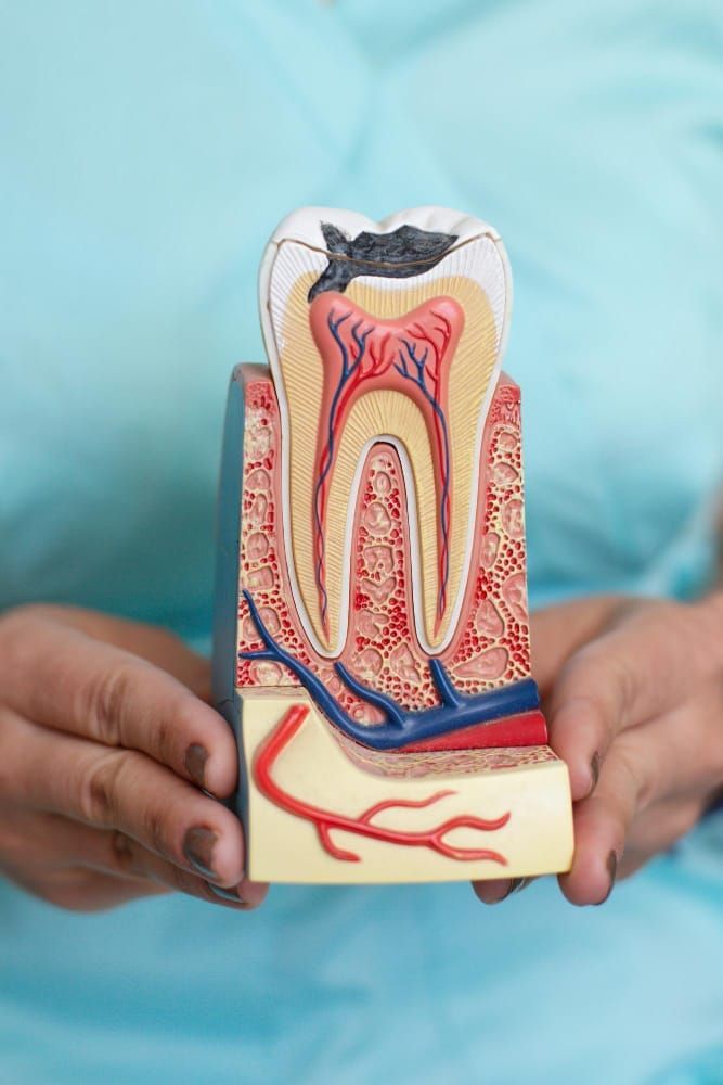 Root Canal Therapy in Berkeley, CA