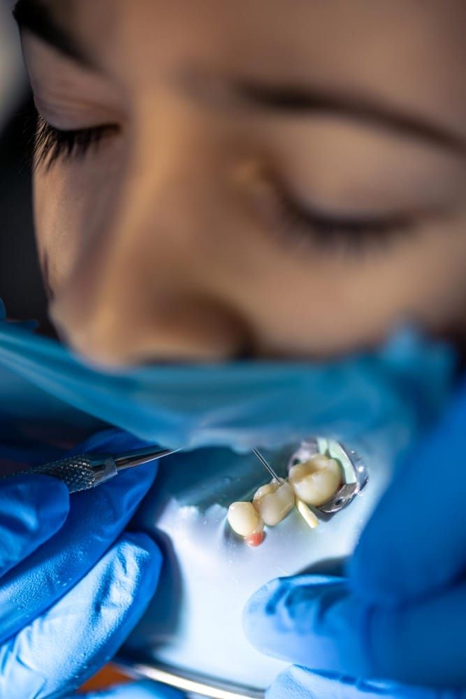 What to Expect During & After Extraction