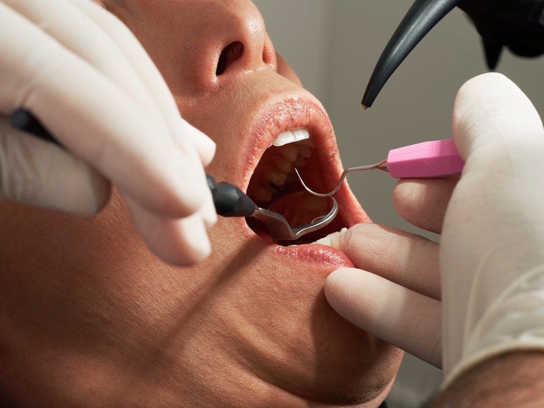Berkeley dental hygienist performing a comprehensive dental cleaning with an ultrasonic scaler