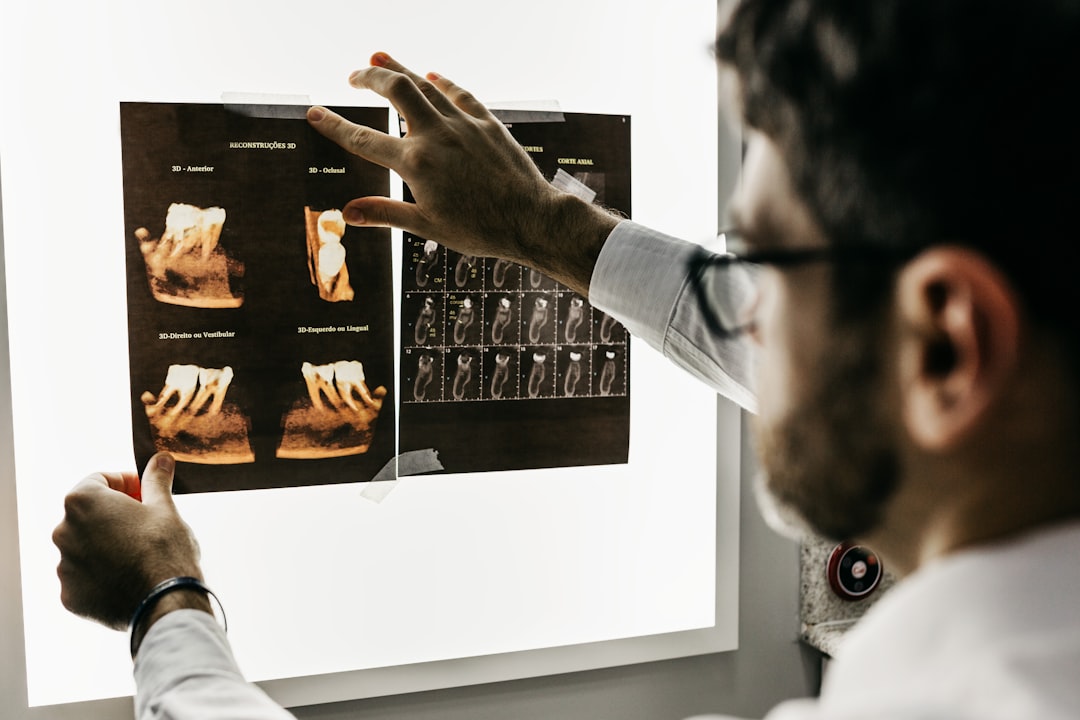 Dentist reviewing dental X-rays after a comprehensive cleaning in Berkeley, CA