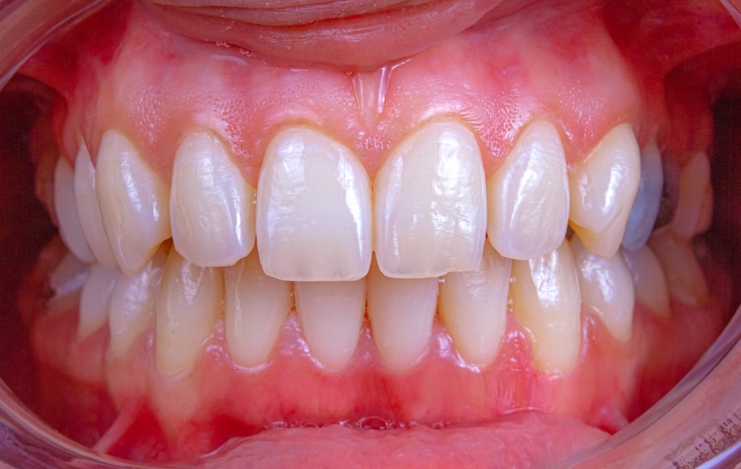 Early Signs of Gum Disease: What to Look For Before It Gets Worse