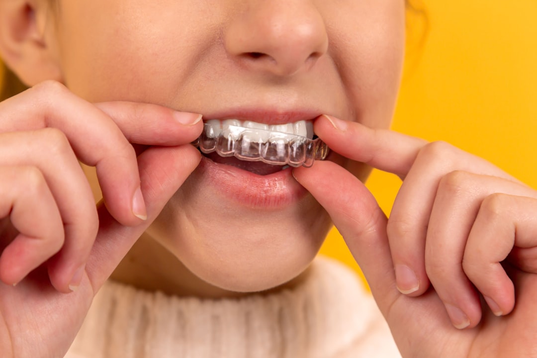 Hand holding a clear retainer tray after Berkeley Invisalign Teen treatment